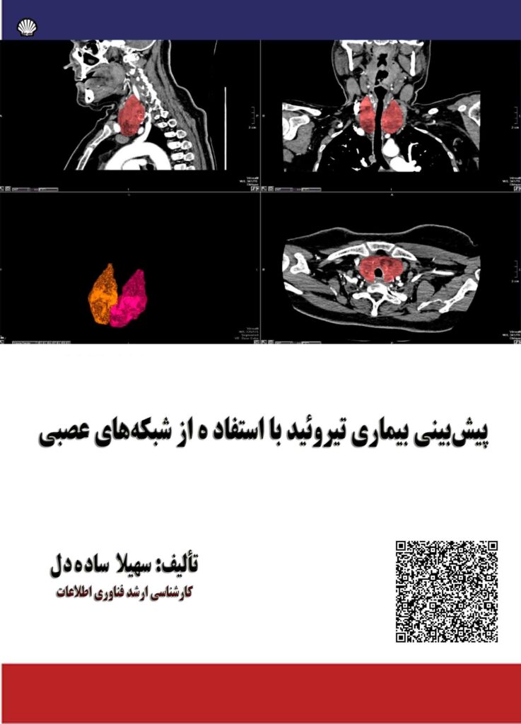 پیش بینی بیماری تیروئید با استفاده از شبکه های عصبی