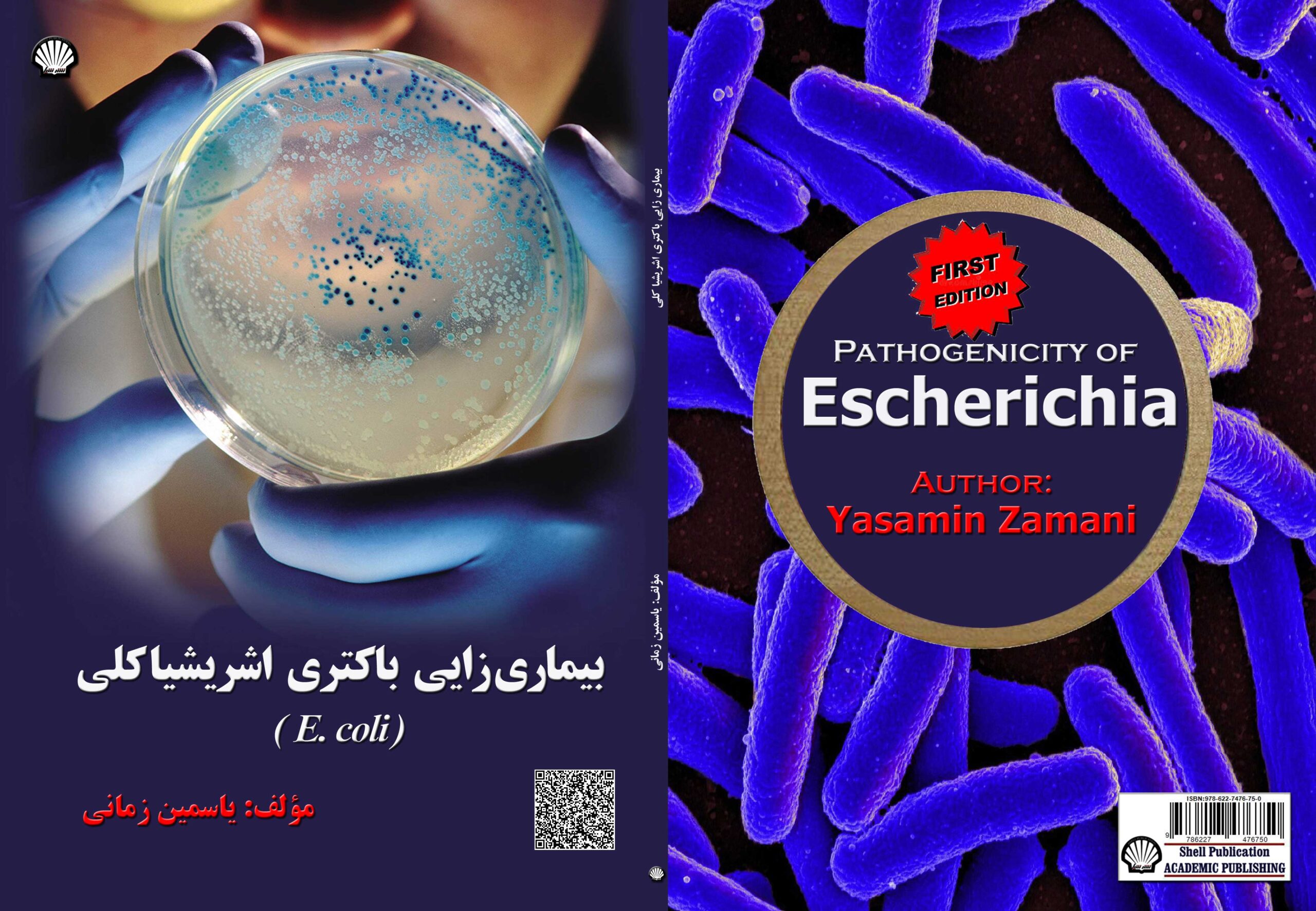 بیماریزایی باکتری اشریشیا کلی (E. coli)