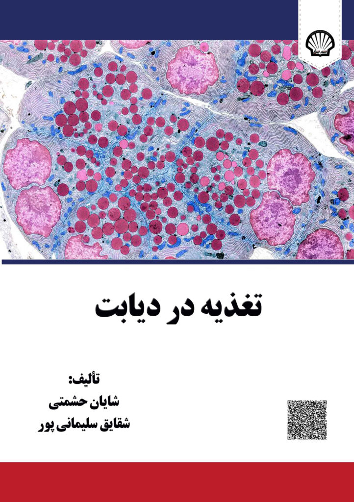 تغذیه در دیابت
